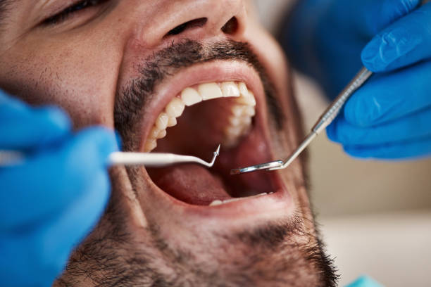 Best Tooth Extraction  in Central, LA